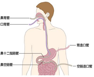 放慢进食节奏对胃肠道健康的积极影响