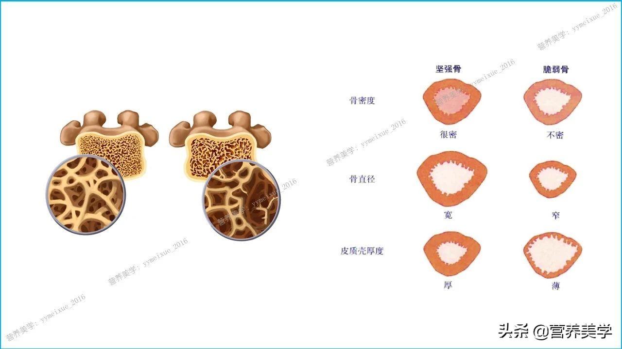 高强度锻炼对肌肉与骨骼的强化作用研究