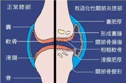 步行减轻关节压力，健康生活的良方