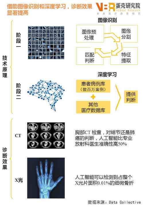 医用AI影像识别技术与辅助诊断效率的提升