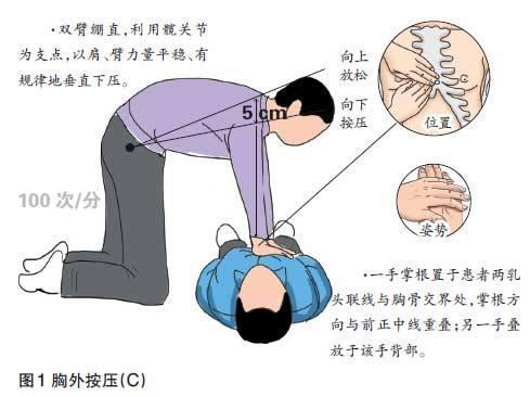 突发跌倒导致的头部损伤应急处理指南